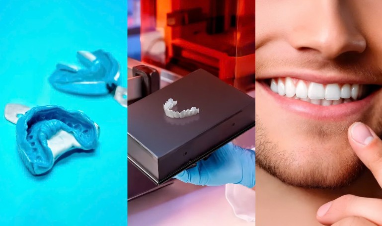 Three panels: metal impression trays filled with blue putty, a gloved hand lifting a freshly printed white veneer arch from a printer, and a close-up of a smiling man's teeth