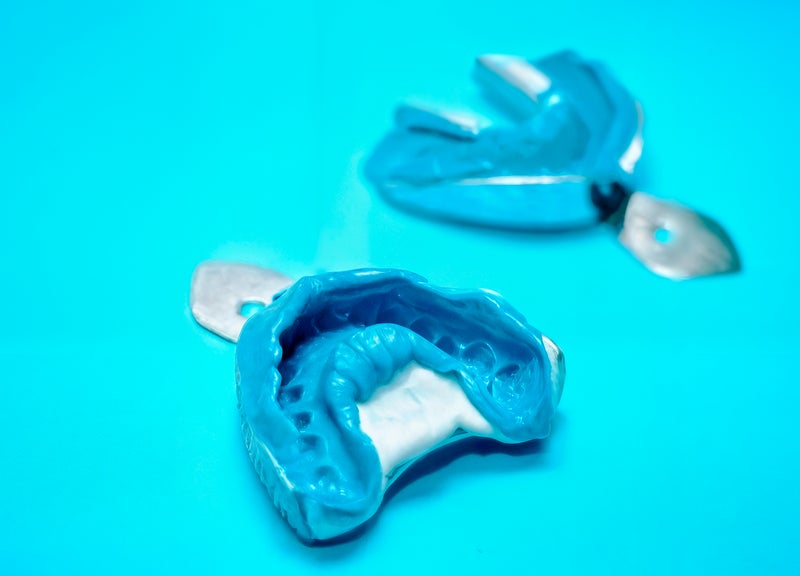 Two dental impression trays filled with blue impression material
